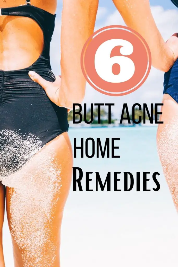 Butt Acne Home Remedies