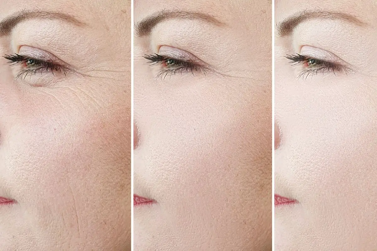 wrinkles under eyes home remedies