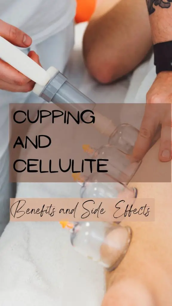 cupping cellulite