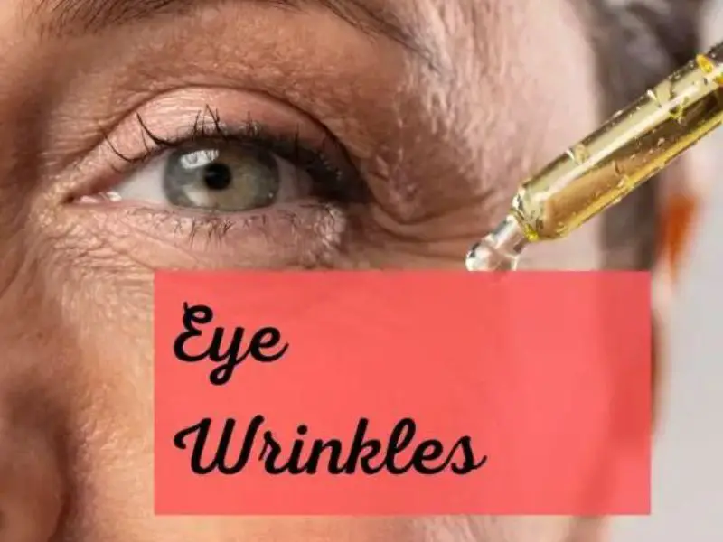 under eye wrinkles home remedies